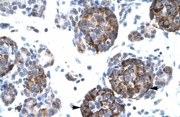 BARX1 Antibody
