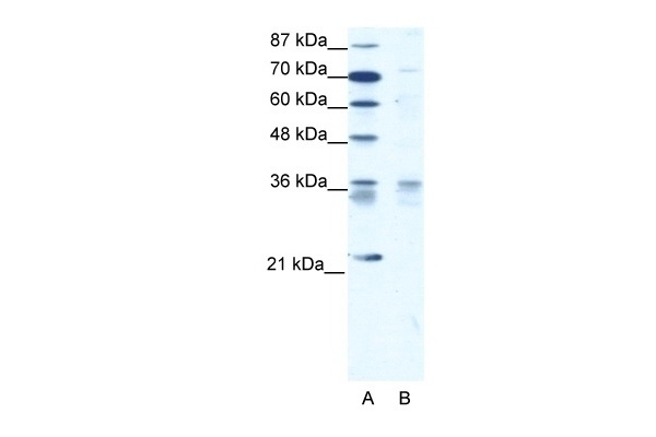 BARX1 Antibody