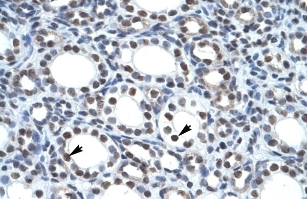 TTRAP Antibody