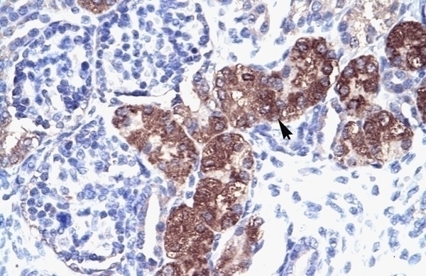 SOX18 Antibody