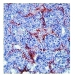 MMP9 Antibody