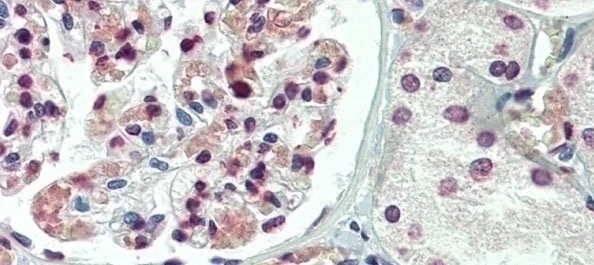 TBX20 Antibody