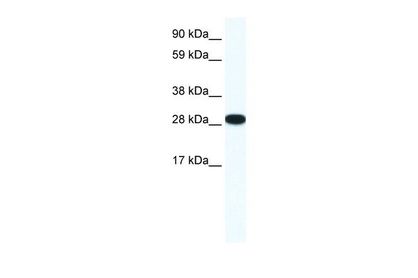 ZFP36L1 Antibody