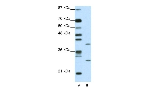 ZFP36L1 Antibody