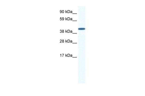 ZFP36L1 Antibody
