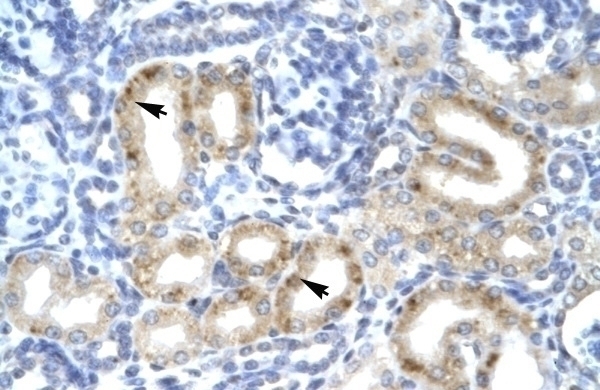 TBX1 Antibody