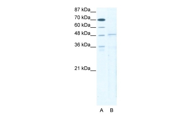 TBX5 Antibody
