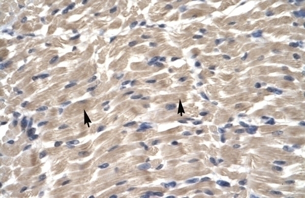 TBX6 Antibody