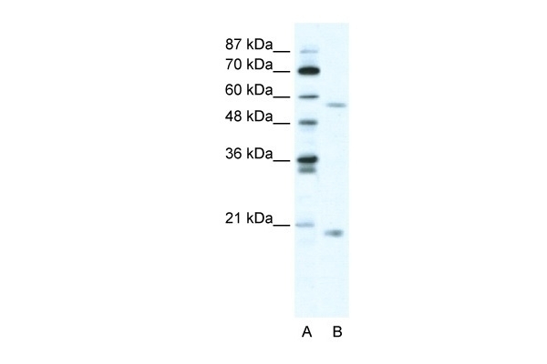 ZNF18 Antibody