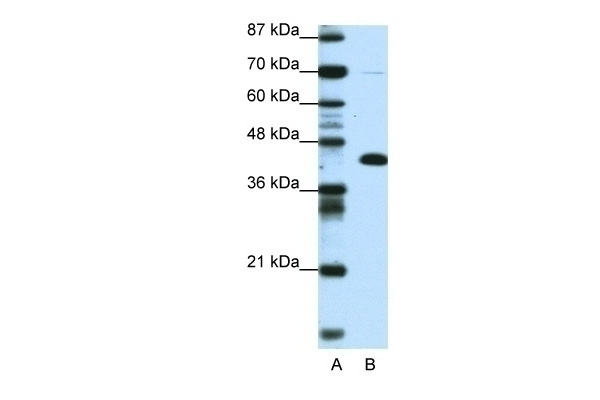 ZBTB25 Antibody