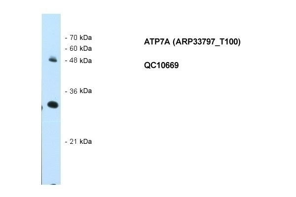 ATP7A Antibody