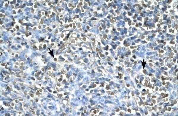 ASGR2 Antibody