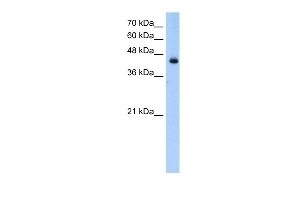 ACADL Antibody