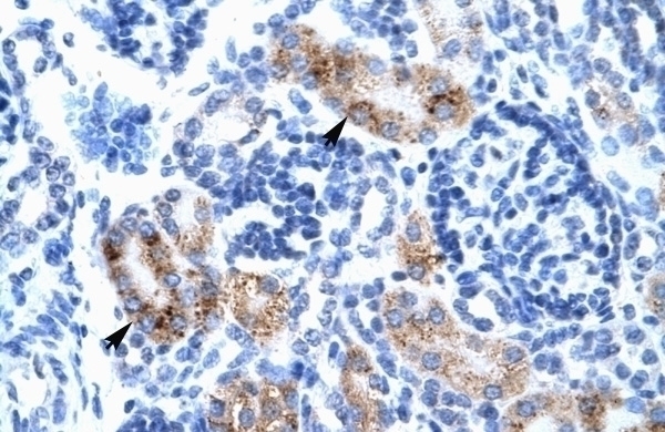ATF2 Antibody
