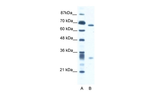 ASH2L Antibody