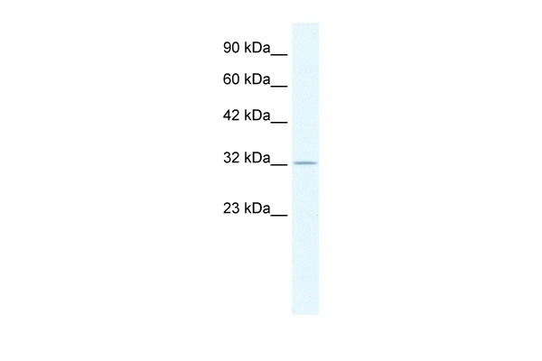 ZFP36 Antibody