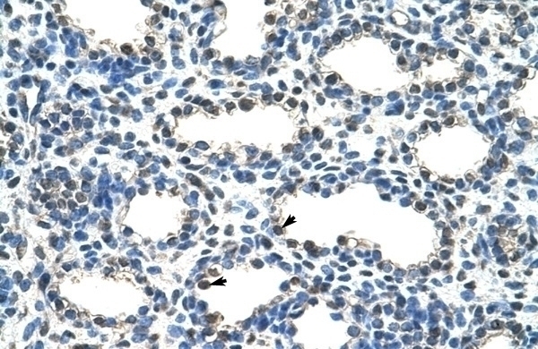 ARIH2 Antibody