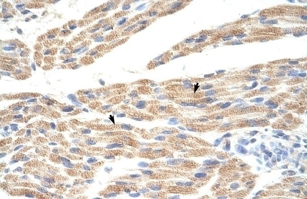 TNRC5 Antibody