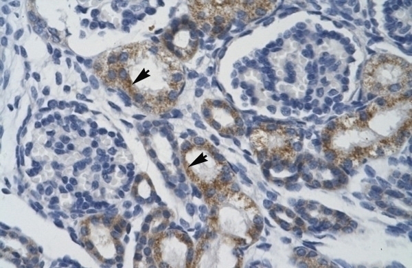 TRIM68 Antibody