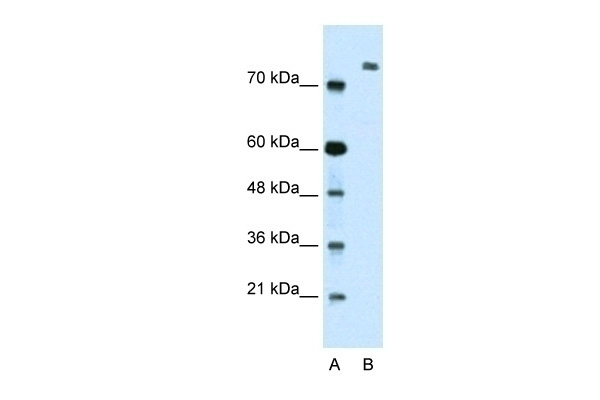 ZMYM3 Antibody