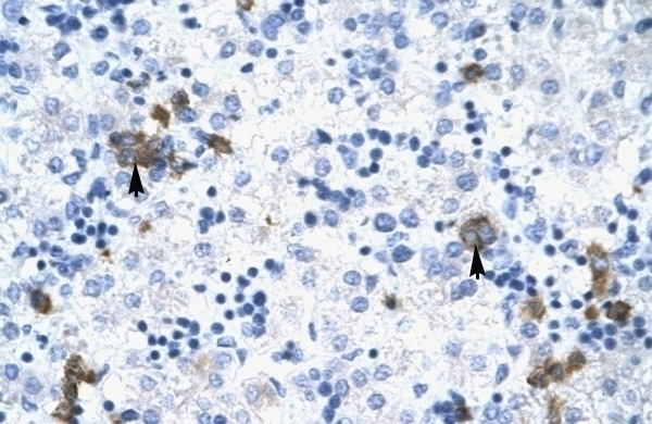 TRIM17 Antibody