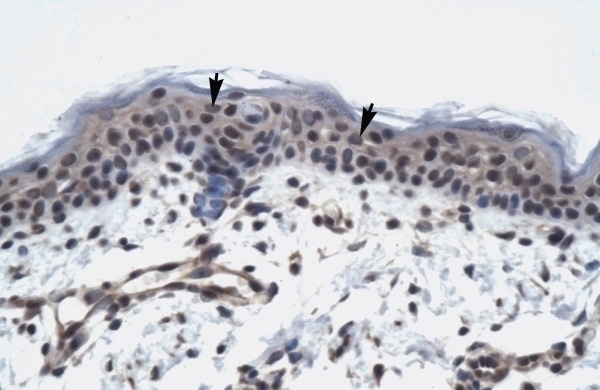 TAF9 Antibody