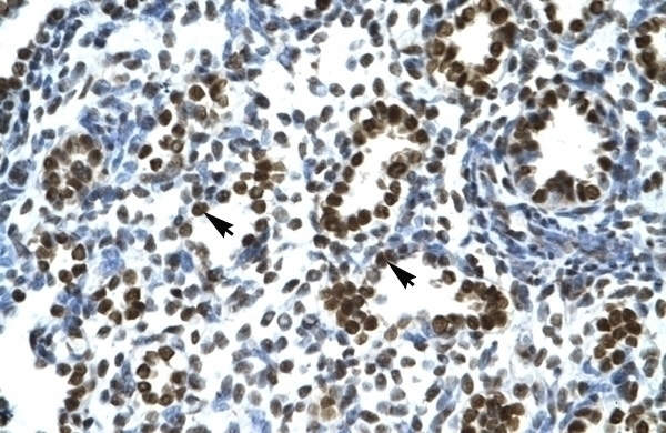 BTBD14B Antibody