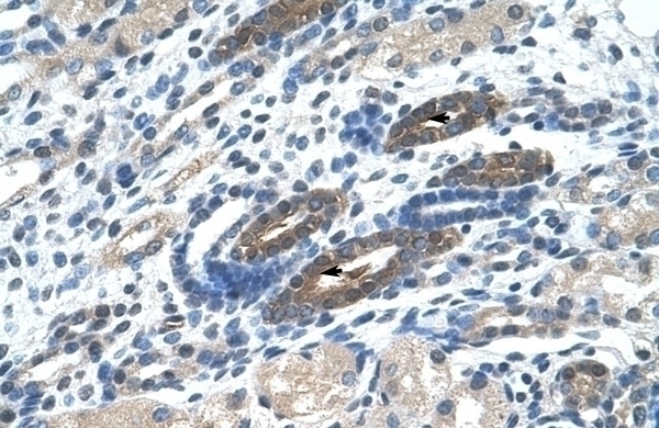BTBD14A Antibody