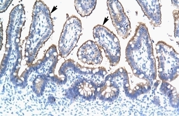 TRIM15 Antibody