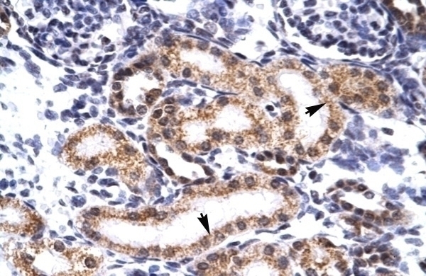 TRIM3 Antibody