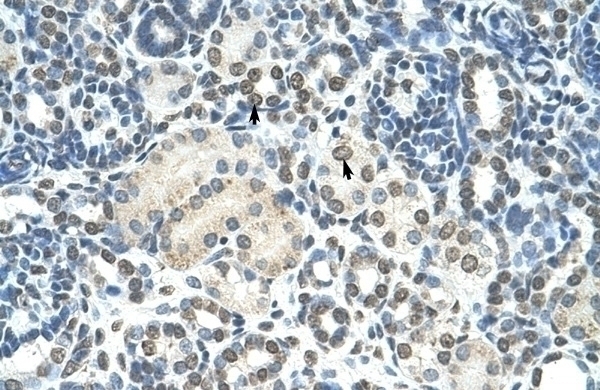 ZMYND11 Antibody