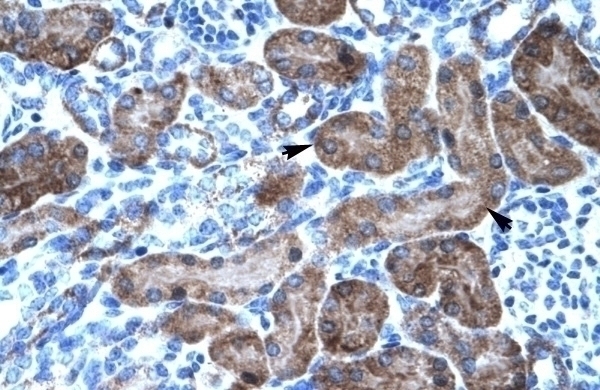 TRIM31 Antibody