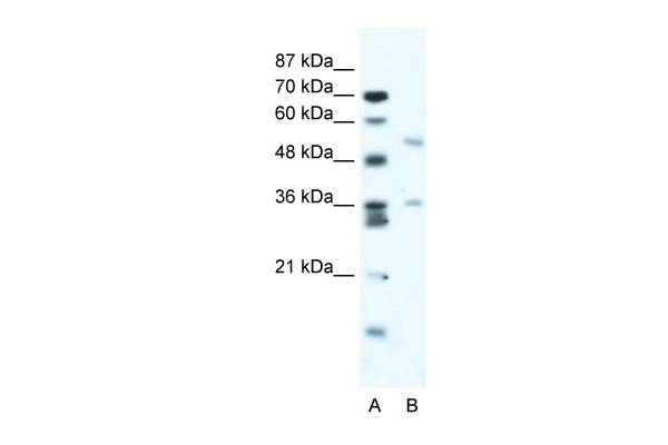BTBD3 Antibody