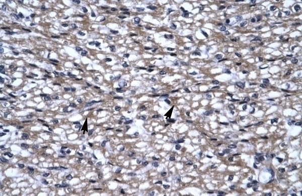 UHRF2 Antibody