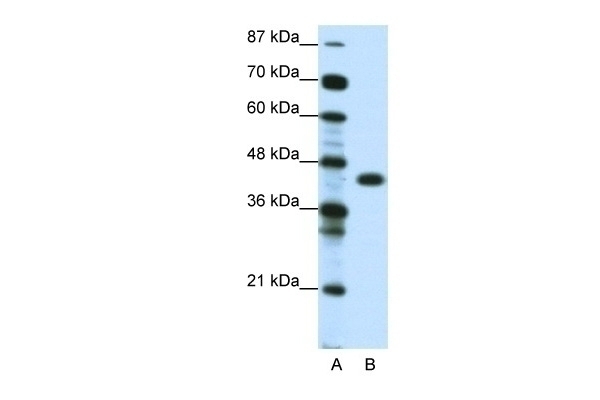 ZNF396 Antibody