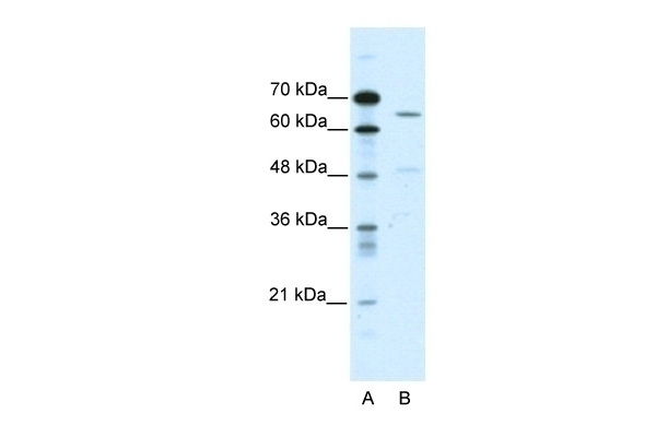 ACCN1 Antibody