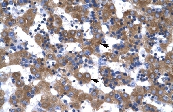 VDAC1 Antibody