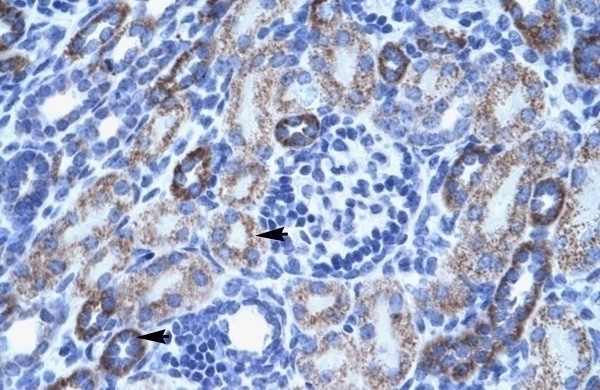 ACCN3 Antibody