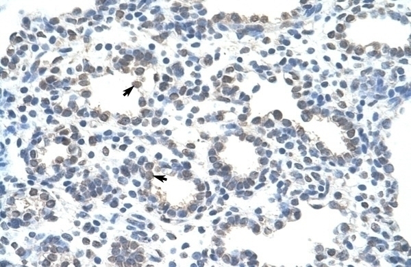 ZRANB2 Antibody