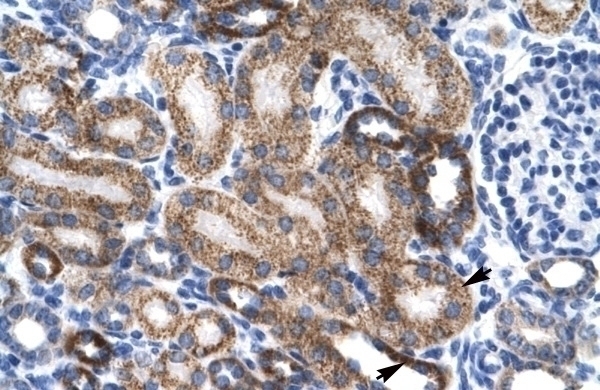 ZNF75 Antibody