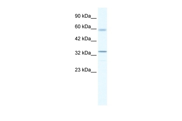 ZBTB7A Antibody