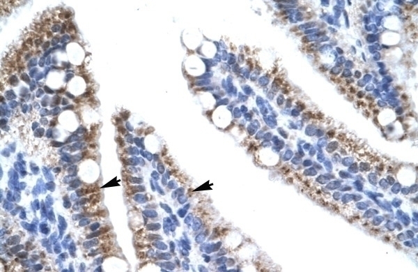 ZNF12 Antibody
