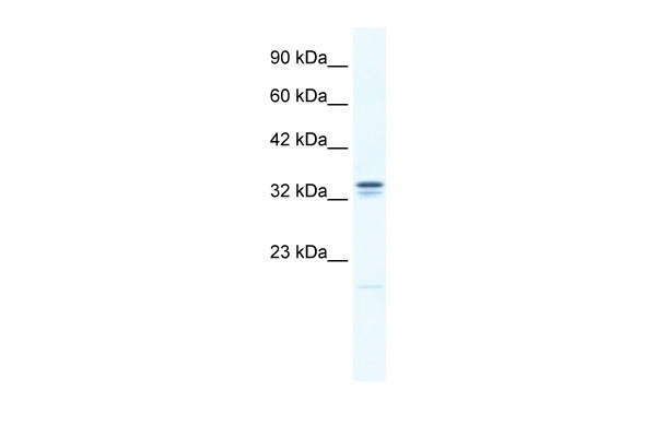ANKZF1 Antibody