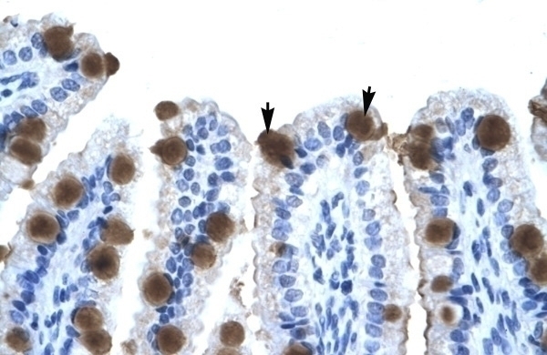 ZNF70 Antibody
