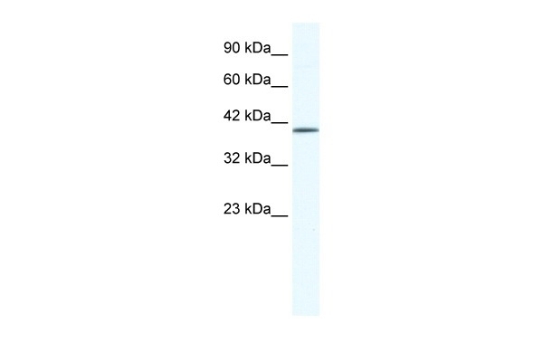 ZNF322A Antibody