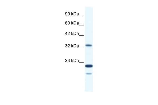 ZNF688 Antibody
