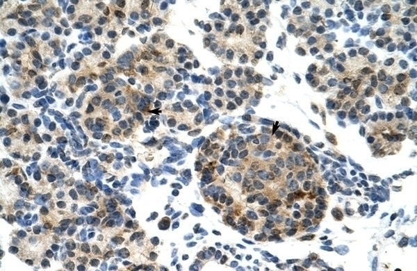 ZNF555 Antibody