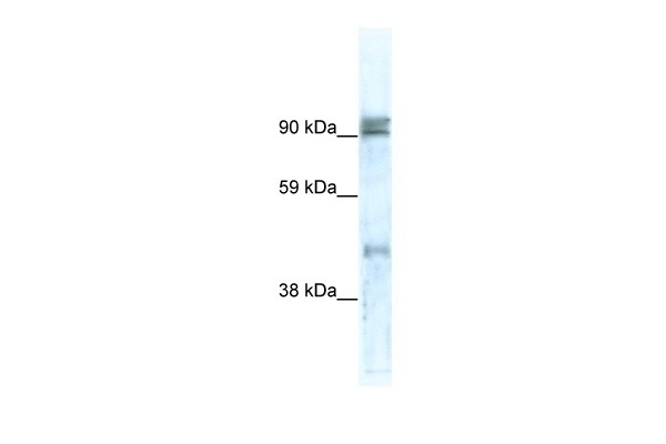 ZNF227 Antibody