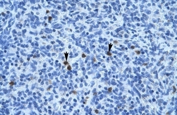 ANXA3 Antibody