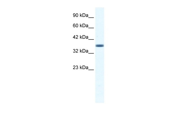 ANXA3 Antibody